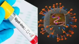 nipahvirus निपाह वायरस संक्रमण क्या है और इसकी रोकथाम?