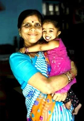 Jyoti Amge With Her Mother Ranjana Amge2 ज्योति आम्गे - Jyoti Amge